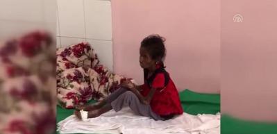 Yemen'den gelen g&ouml;r&uuml;nt&uuml;ler boğazları d&uuml;ğ&uuml;mledi