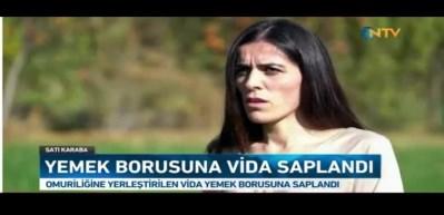 Yıllarca yemek yemekte zorlandı, sebebi doktorları bile şoke etti