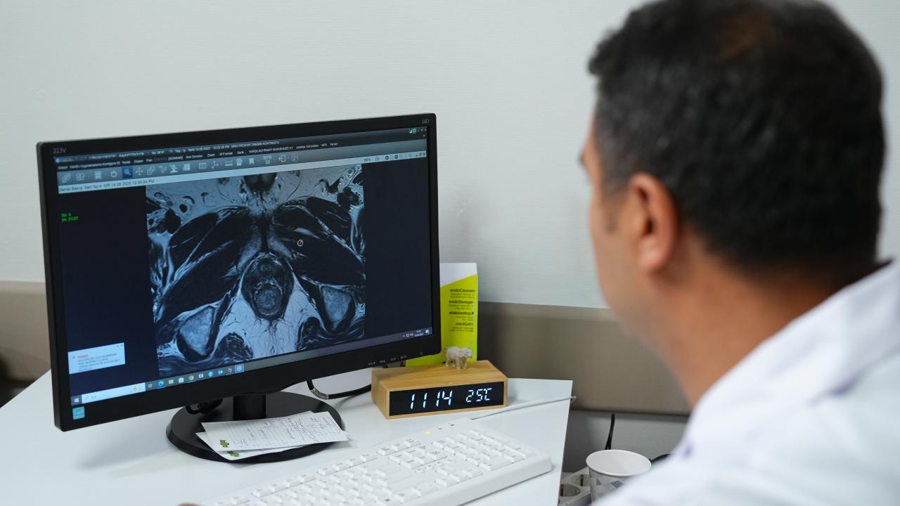 Prostat kanserinde erken ve doğru tanı için 'Füzyon biyopsi' dönemi