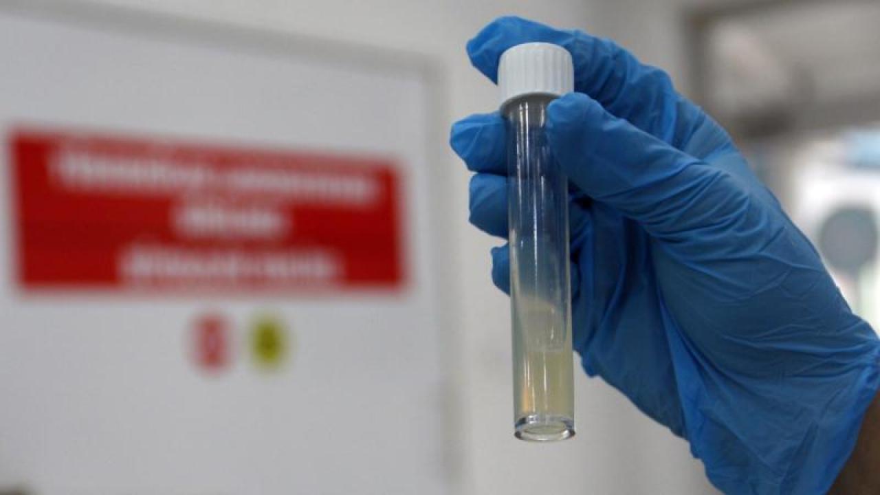 DSÖ açıkladı... Dünyanın en ölümcül bulaşıcı hastalığı oldu! 2024'te 1,23 milyon can aldı