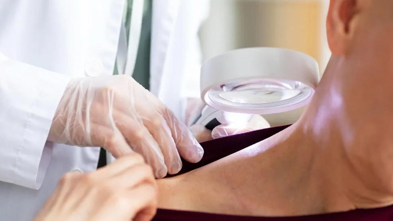 Cilt kanseri riskini 3 kata yakın artırıyor! Popüler diye yapmayın