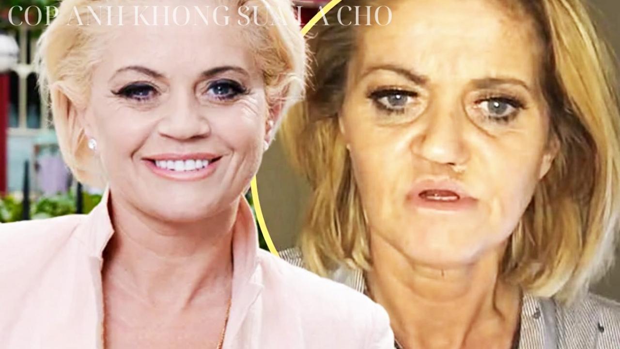 Uyuşturucu ünlü yıldızın yüzünü mahvetti