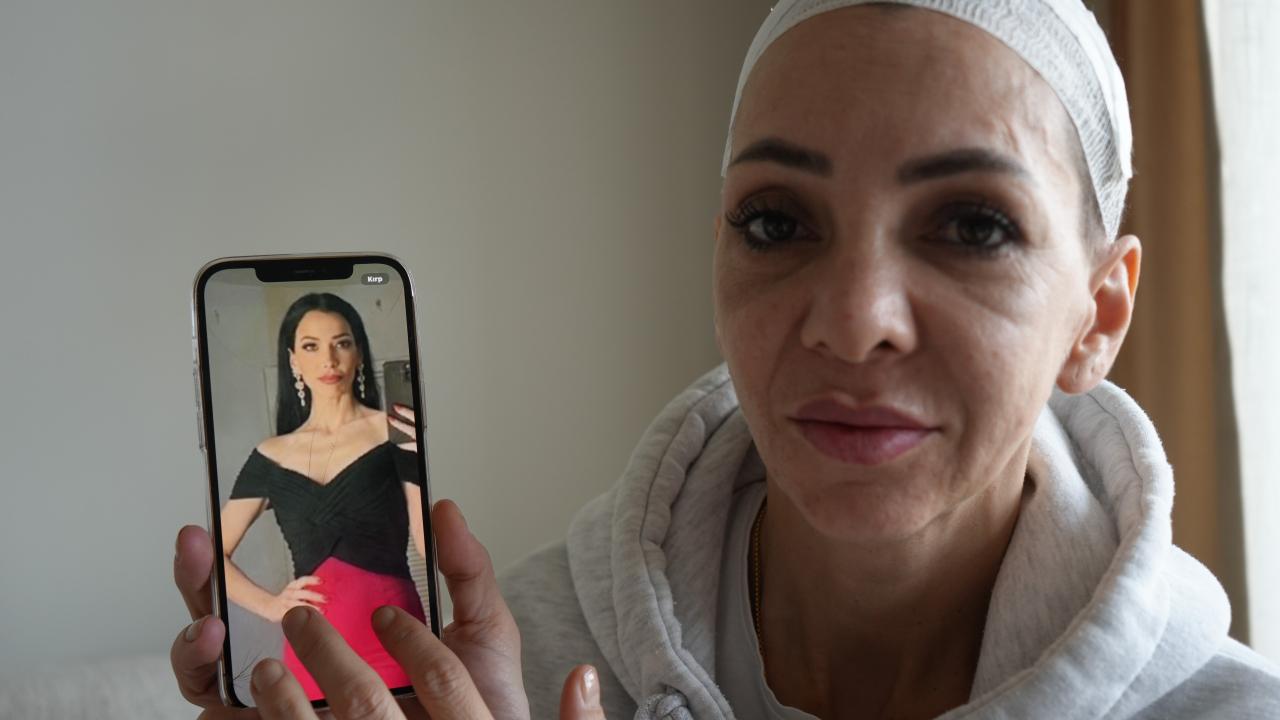 Yüzü parçalanan annenin hukuk mücadelesi: Hem darbedildi hem tehdit ediliyor