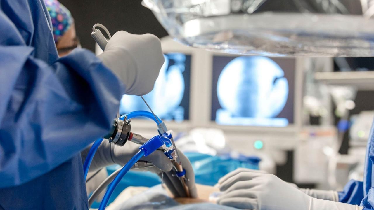 Milyonları etkileyen omurga sorunlarında kişiye özel cerrahi dönemi