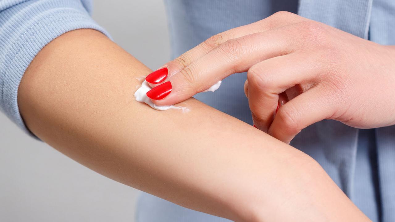 Böcek ısırığı kremi: Bu yaz kaşıntıya son