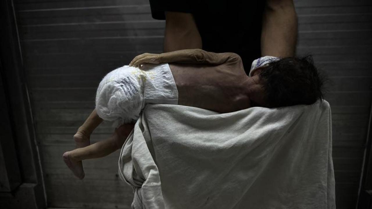 Gazze’de sessiz felaket: Bebeklerde anomali ve ölüm oranları artıyor