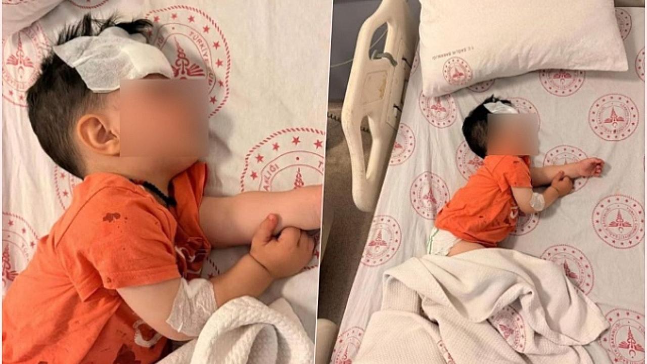 Şanlıurfa’da küçük çocuğu yaralayan köpek saldırısına idari soruşturma Şanlıurfa’da küçük çocuğu yaralayan köpek saldırısına idari soruşturma