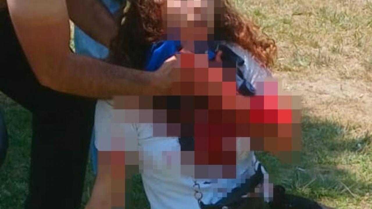 Millet Bahçesi’nde kanlı buluşma: Boşanma aşamasındaki eşini parkta boğazından bıçakladı Millet Bahçesi’nde kanlı buluşma: Boşanma aşamasındaki eşini parkta boğazından bıçakladı