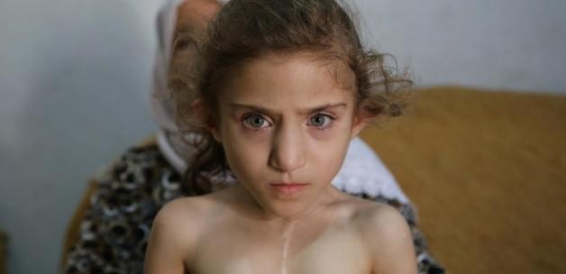 Yanlış iğne Suriyeli Dua'yı felç bıraktı