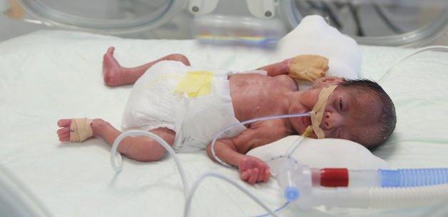 "Parmak bebeğin" kalbine ameliyatsız tedavi