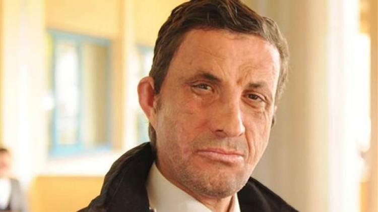 yuz nakli olan ugur acar in hayali