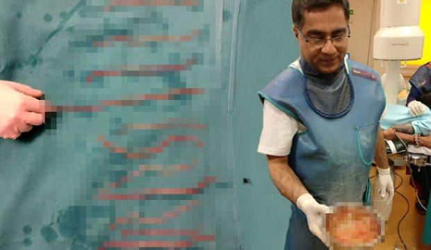 Aylarca acı çekti, doktorlar bile şaşkına döndü!