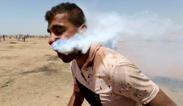 Ağzına gaz bombası saplanmıştı! Haber geldi