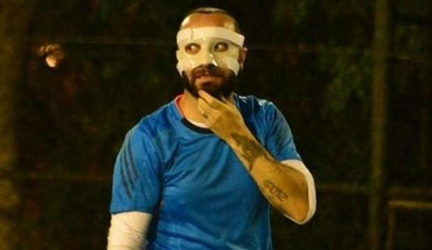 Arda'nın burnunu kırdığı Berkay'ın son hali