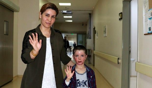 Vücudu yanan Erbilli çocuk, Türkiye'de şifa buldu