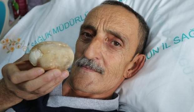 Doktor Sasti Kaldi Boylesini Gormedim Tam 522 Gram Guncel Haberleri