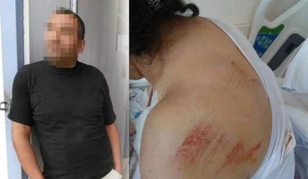 Odun kesen komşu kadını dövüp, nacakla saldırdı