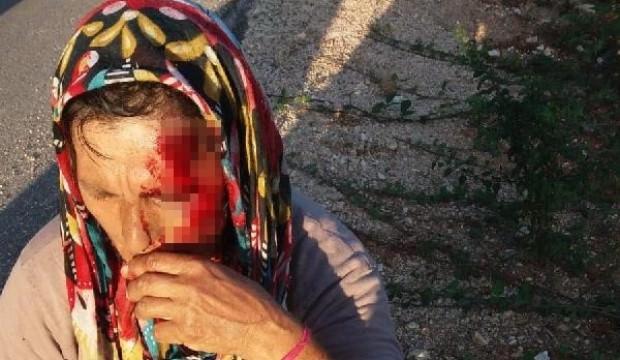 Koç, sahibini hastanelik etti