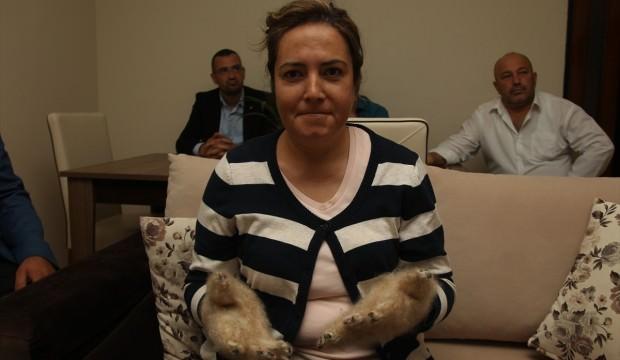 'Raynaud fenomeni' hastasına Savcı Sayan'dan destek
