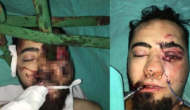 Dehşete düşüren kaza! Ameliyatına itfaiye de girdi