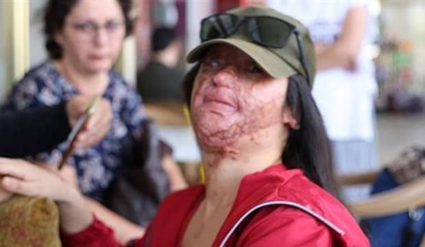 Bakan Selçuk'tan Berfin'in yüzüne asit atan sanığa verilen cezaya tepki