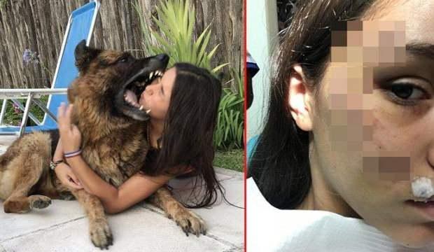 Sevmeye çalıştığı köpek, yüzünü ısırdı!
