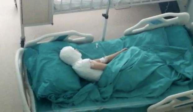 Üvey anne dehşeti: Kaynar su döktü!