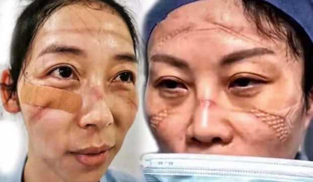Hemşirelerin ürküten görüntüsü! Koronavirüste ölü sayısı 564'e çıktı