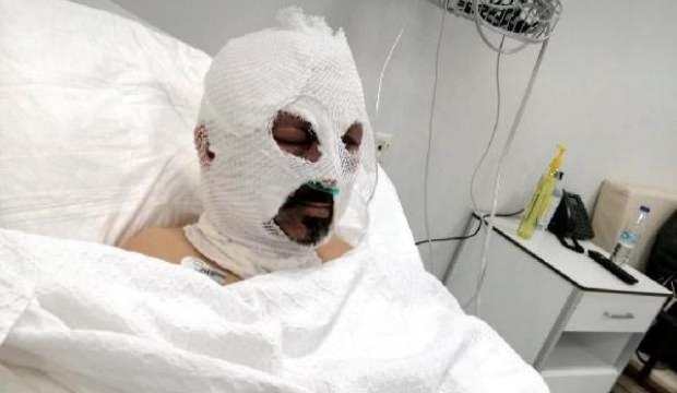 Akılalmaz olay! Şoförün üzerine tiner döküp yaktı...