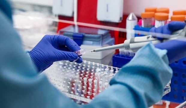 Koronavirus Is Kazasi Sayilacak Mi Maddi Ve Manevi Tazminat Hakki Dogabilir Ekonomi Haberleri