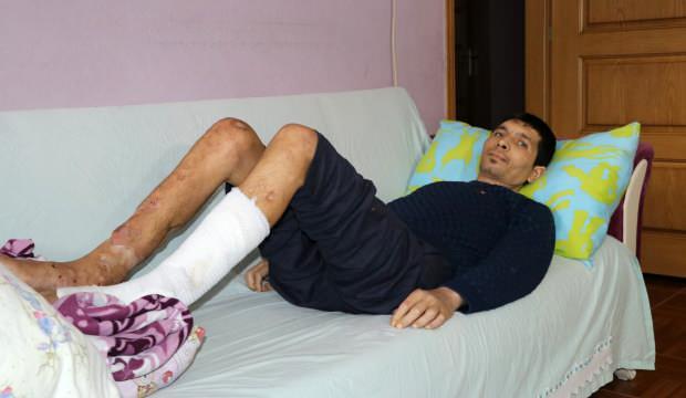 Bacağındaki açık yaralar 4 yıldır yatağa mahkum etti