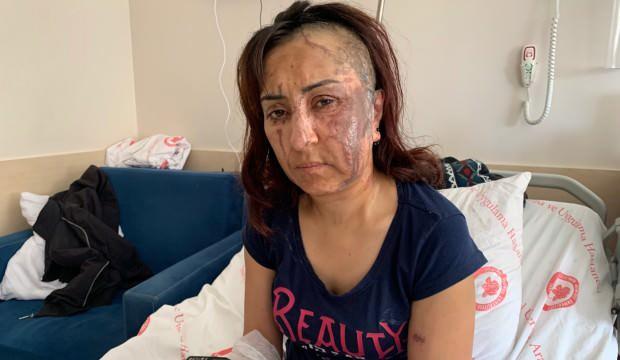 Boşanmak isteyen eşine kezzapla saldırdı