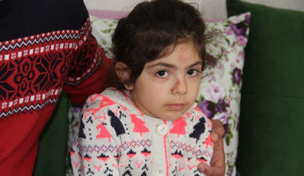 Evinin önünde araba çarpan küçük kız korkudan sokağa çıkamıyor