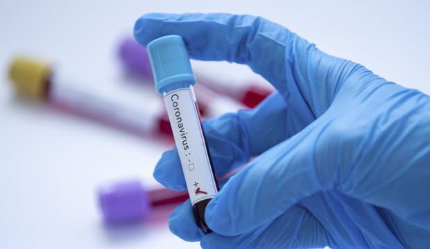 Koronavirüs vaka sayısı 8.5 milyonu aştı!