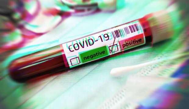 Koronavirüsü geçirdiğini düşünenlere müjde! Başvur, bedavaya antikor testi yaptır