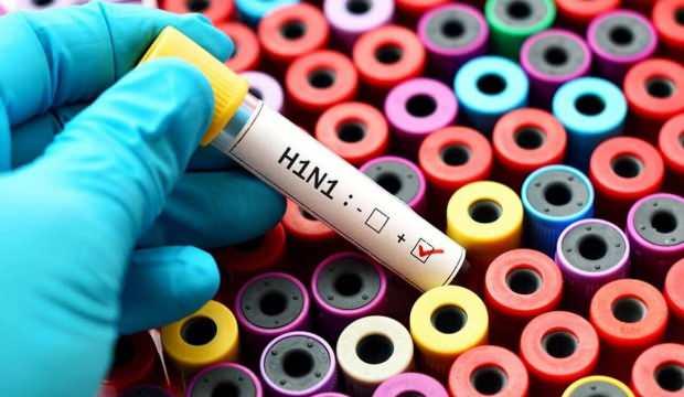 Corona virüsün ardından Çin'de ortaya çıkan G4EA H1N1 virüsü nedir?