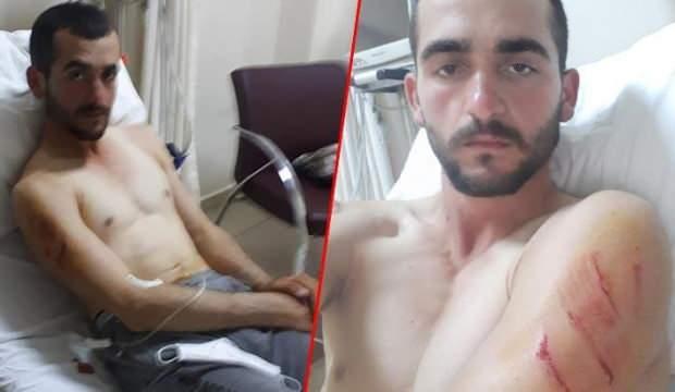 Bilecik’te ayının saldırdığı genci köpekleri kurtardı!