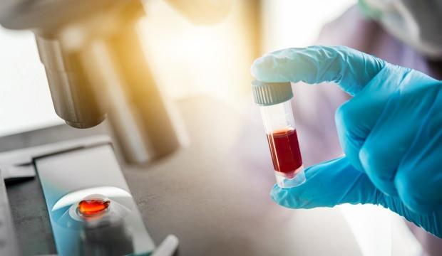 Bilim Kurulu üyesi Özlü'den ezberleri bozan uyarı!