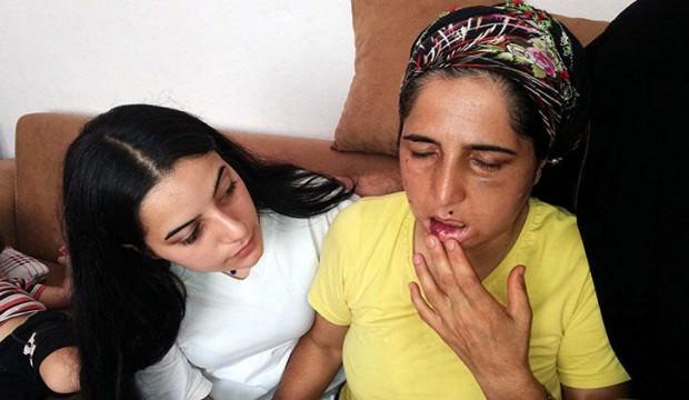 22 yıllık eşinden işkence gören kadın koruma altına alındı