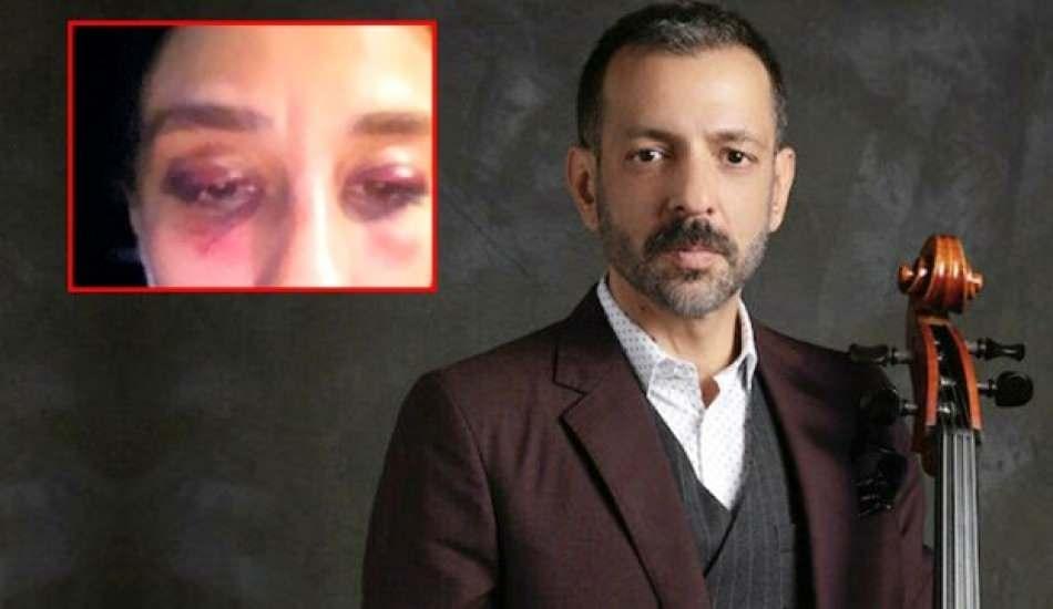 rubatonun_solisti_ozer_arkun_hakkinda_35_yil_hapis_istemi_1601710722_5301.jpg