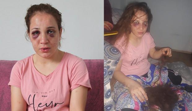 Saçları yolundu gözleri mosmor oldu! Yardım bekliyor