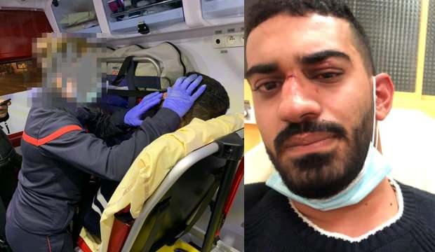 Ürdünlü iki kardeşe ırkçı şiddet: Burası Fransa niye Arapça konuşuyorsunuz
