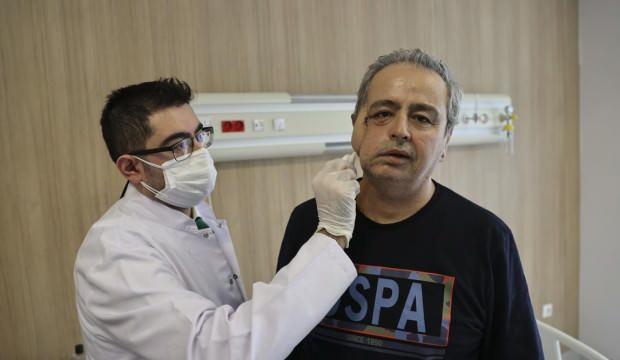 Kanserden yüzünün yarısını kaybetmişti! Yapay kemik ve omuz ile yeni yüz yapıldı