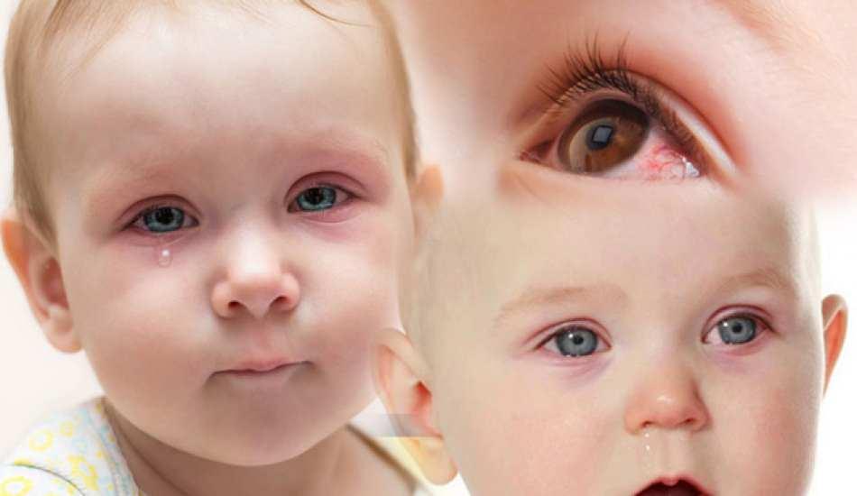 bebeklerin gozleri neden kanlanir yeni dogan bebekte goz kanlanmasi nasil gecer 1613468025 142