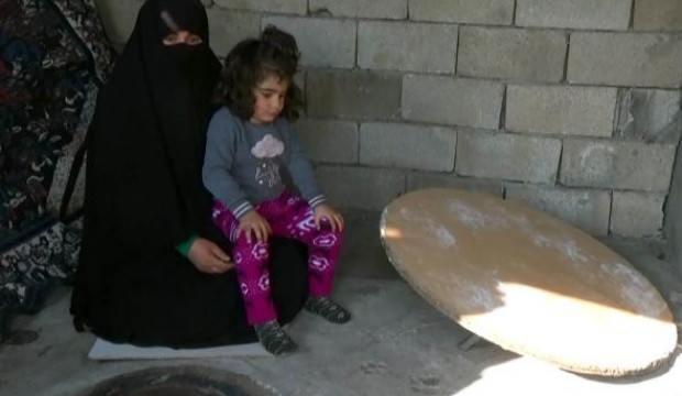 Belden aşağısı tandırda yanan Fatmanur, ayakkabı giyip, koşmak istiyor