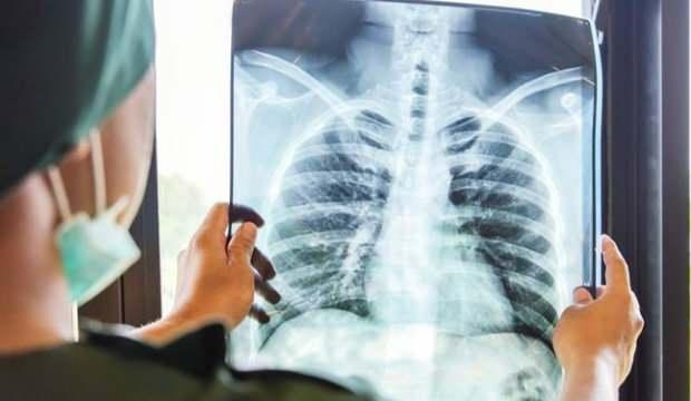 Sigara içenler koronaya yakalanmıyor demişlerdi! Skandal ortaya çıktı
