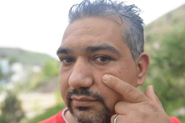 NmtkL 1620385061 5519