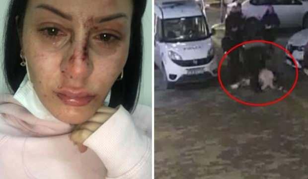 Kadına şiddet uygulayan polisin FETÖ soruşturması geçirdiği ortaya çıktı