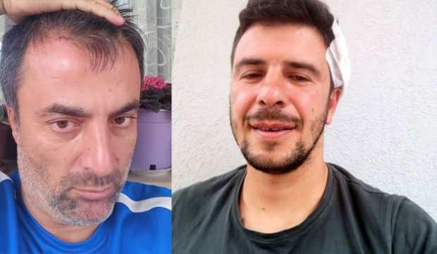 Trabzon’da futbol sohbeti levyeli kavgayla son buldu