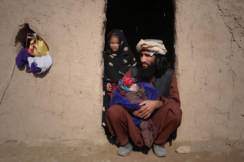 Afganlar şiddetlenen yoksullukta organlarını satıyor